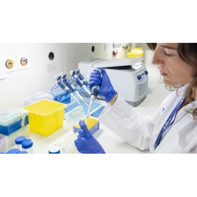 Identifican un mecanismo que favorece la metástasis del cáncer de colon al hígado