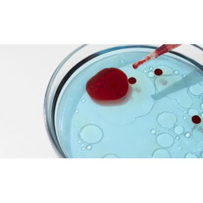 La anemia: una enfermedad prevenible, tratable y superable