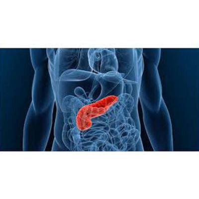 Diseñan un nuevo fármaco contra el cáncer de páncreas que "promete tratamientos más efectivos que la quimioterapia tradicional"