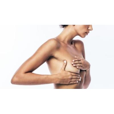 La IA eleva un 15% la detección de cáncer de mama