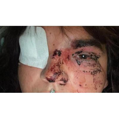 Miss Trans Zamora, brutalmente agredida al intentar acceder a un baño de mujeres en León