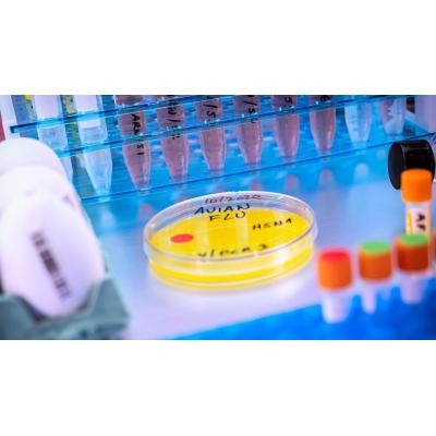 Registran el primer caso humano importado de infección por gripe aviar A en la Unión Europea