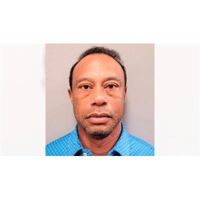 La policía revela que Tiger Woods tenía un medicamento opioide en el bolsillo en su arresto en Florida