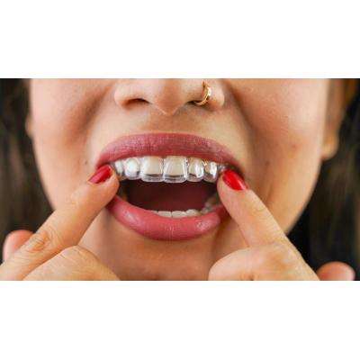 Prueba gratis la ortodoncia invisible en Pamplona con Sonrisalud