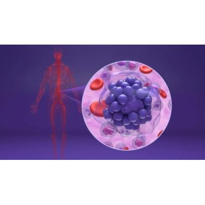 La molécula microARN miR-28 reduce la resistencia a ibrutinib, el fármaco empleado en un tipo agresivo de linfoma de células B