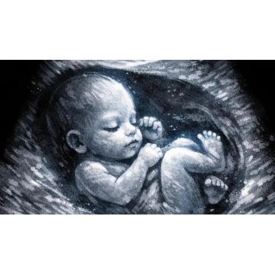 Un experto recuerda que "la ecografía de la semana 36 es clave para prevenir complicaciones graves en el embarazo"
