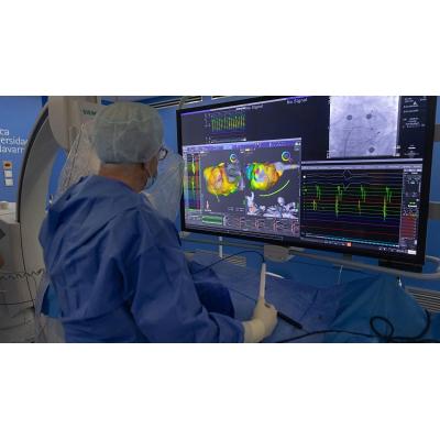 La Clínica Universidad de Navarra, primer hospital del país y el segundo de Europa en implantar una nueva técnica que localiza focos de arritmias y las trata individualmente