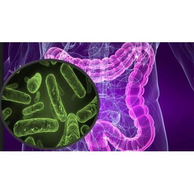 El análisis de los microbios en el intestino puede predecir el riesgo de Parkinson